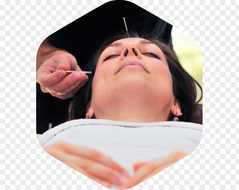Acupuncture Arbour Chin Cheek Bodywork PNG