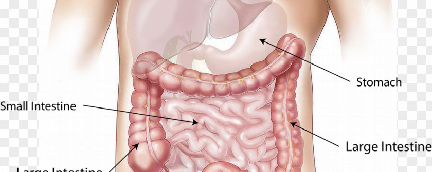 Colon Cancer Nutrient Human Body Digestion Gastrointestinal Tract Feces PNG