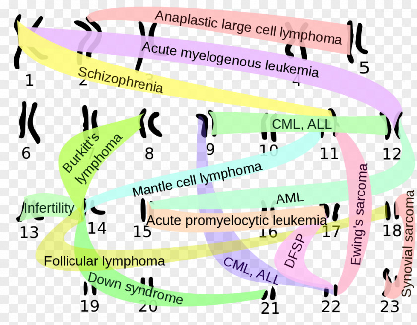 Chromosomal Translocation Philadelphia Chromosome Abnormality Karyotype PNG