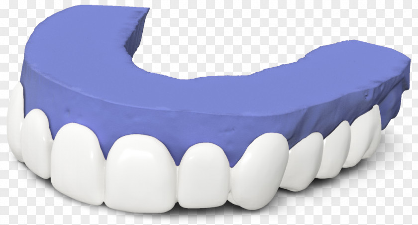 Tooth Veneer Dentistry Dental Laboratory PNG