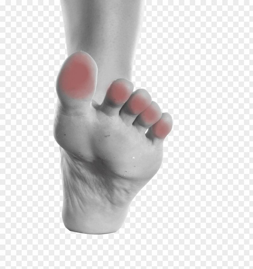 Nail Thumb Toe Onychocryptosis Foot PNG