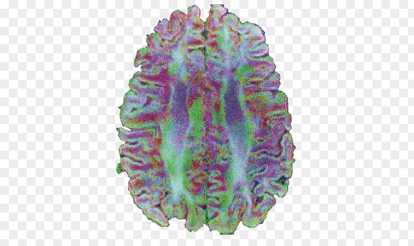 Brain Purple Medicine PNG