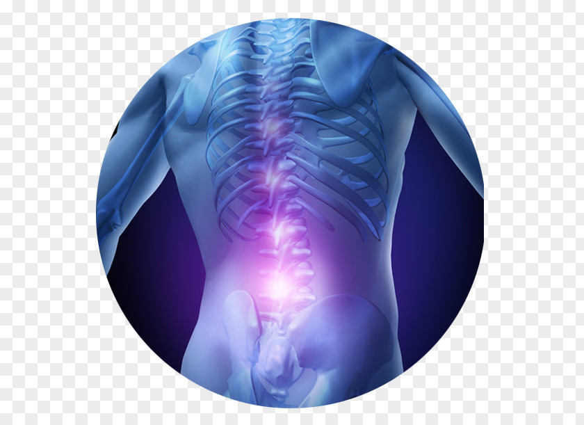 Pain Low Back Management Therapy Spinal Disc Herniation PNG