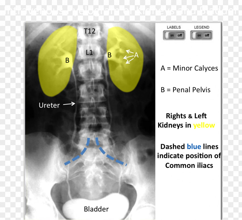 Medical Imaging Radiology X-ray Medicine PNG