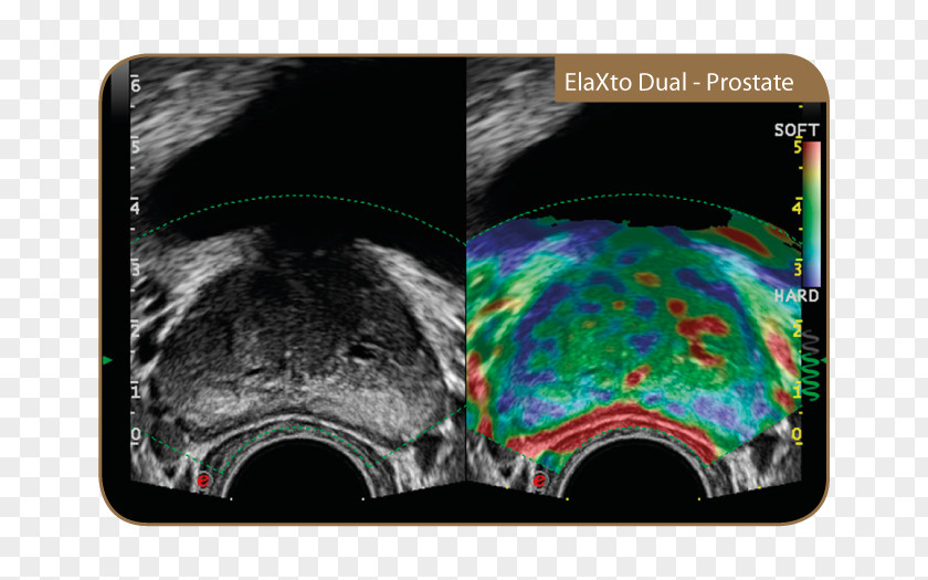 Advanced Technology Ultrasonography Medicine Bmt Medtekhnika Medical Equipment Magnetic Resonance Imaging PNG