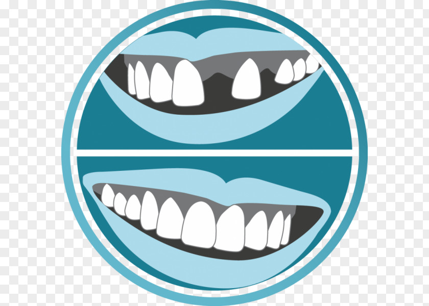Smile Tooth Ewan Bramley Dental Care Mouth Dentist PNG