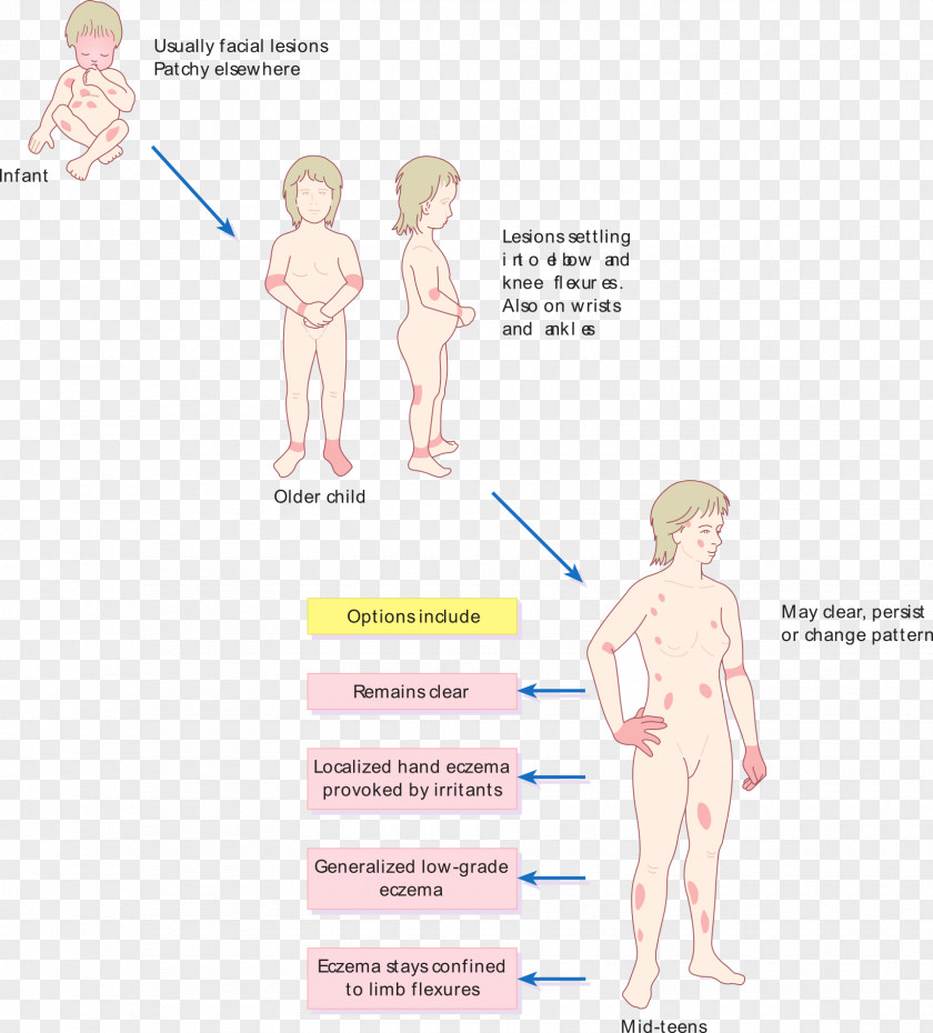 Aging Atopic Dermatitis Atopy Disease Itch PNG