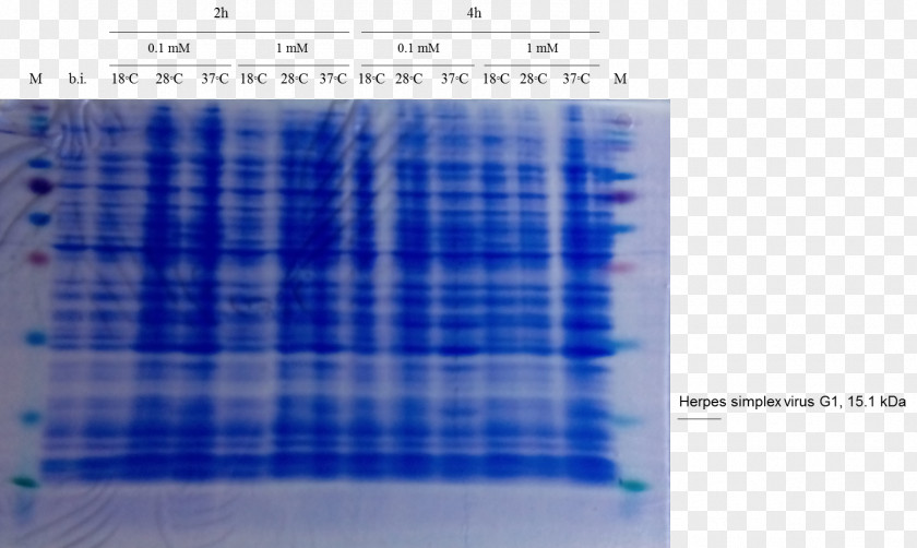 Herpes Simplex Virus Western Blot Cell SDS-PAGE Staining Polyacrylamide Gel Electrophoresis PNG