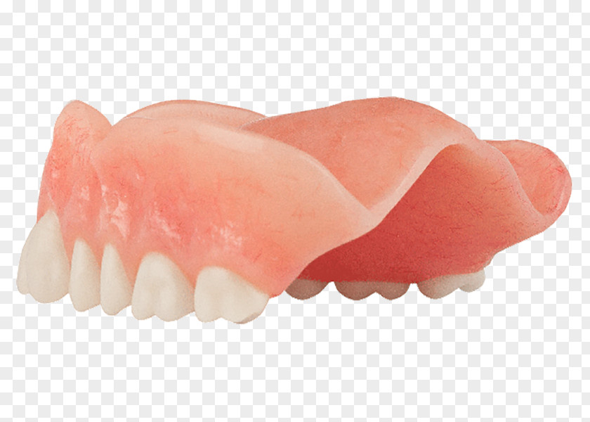 Tooth Dentures Dentistry All-on-4 Dental Implant PNG