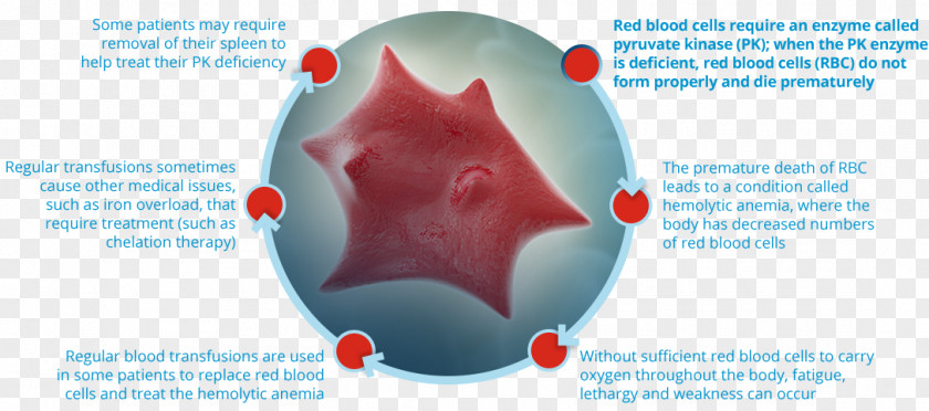 Mevalonate Kinase Deficiency Pyruvate Iron Anemia PNG