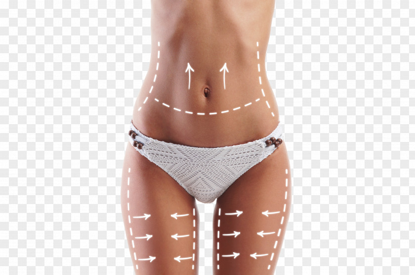 Arrow Female Body Weight Loss Adipose Tissue Liposuction Mud Wrap Cellulite PNG