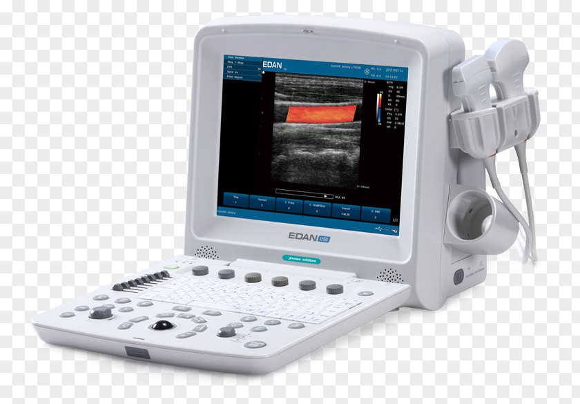 Sonosim Edan USA Diagnostic Ultrasound Ultrasonography Medical Imaging PNG