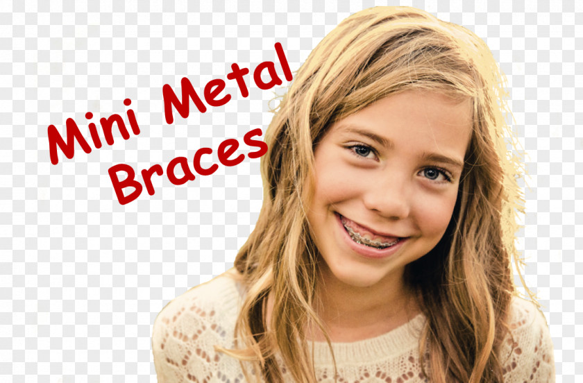 Braces Dental Orthodontics Clear Aligners Human Tooth PNG