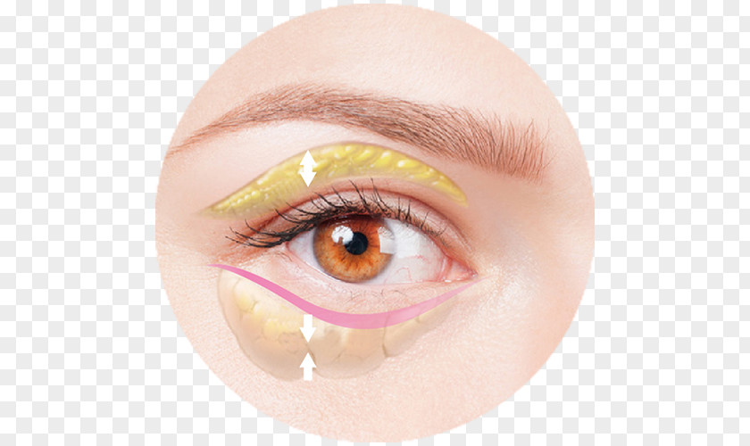 Double Eyelids Face Eye Skin Enophthalmia Medicine PNG