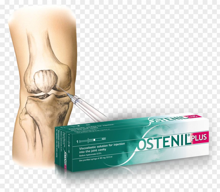 Hyaluronic Acid Osteoarthritis Therapy Joint Injection PNG