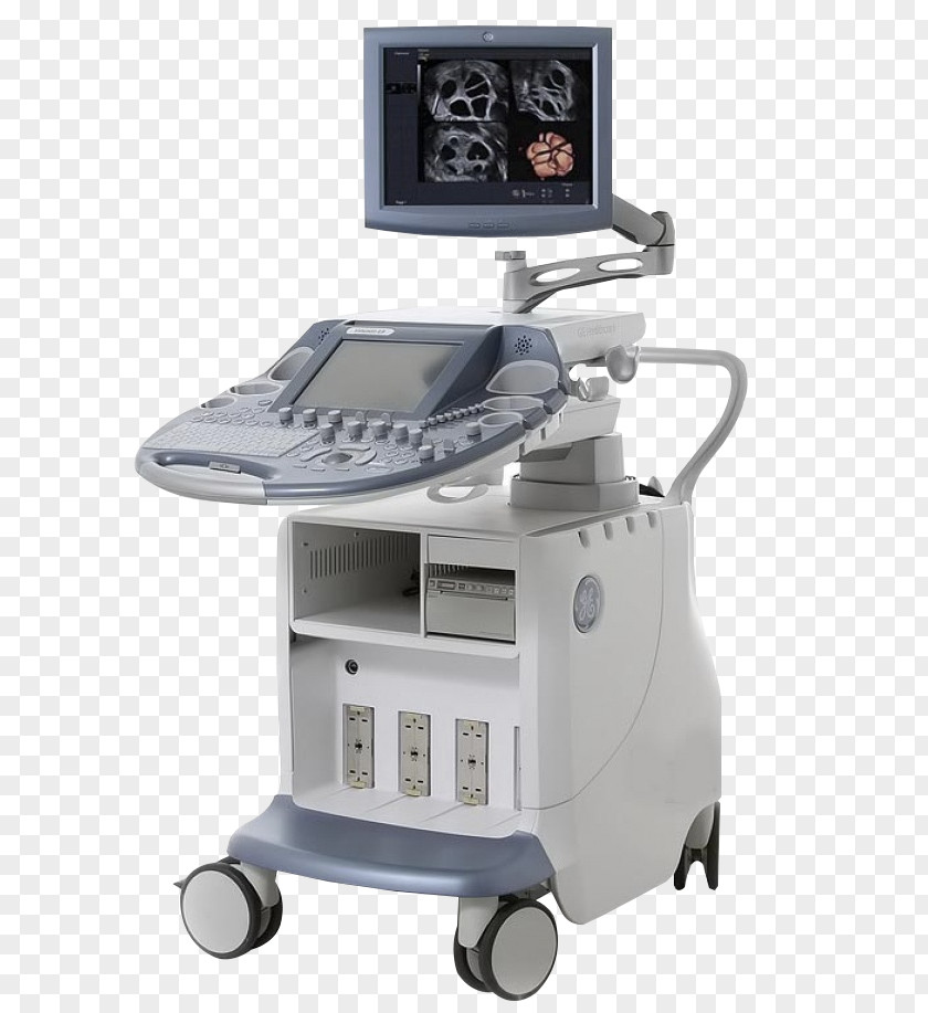 Voluson 730 Ultrasonography Portable Ultrasound 3D PNG