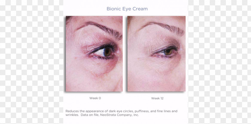 Eye Periorbital Dark Circles Cream Eyelash Extensions Visual Prosthesis PNG