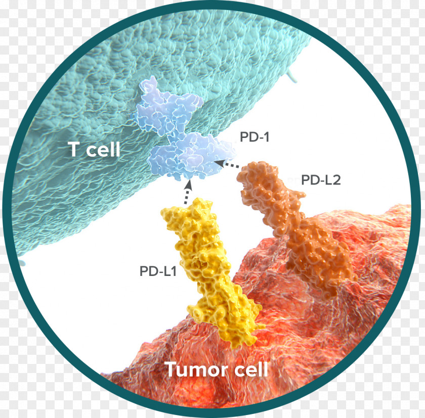 Carcinoma Programmed Cell Death Protein 1 Immune System Natural Killer Cancer PNG