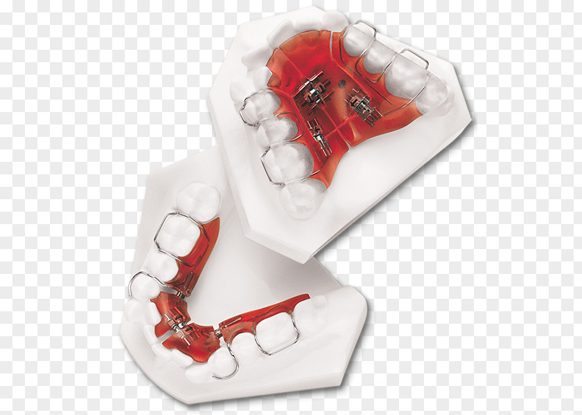 Orthodontic Correction Sagittal Plane Coronal Occlusion DynaFlex PNG