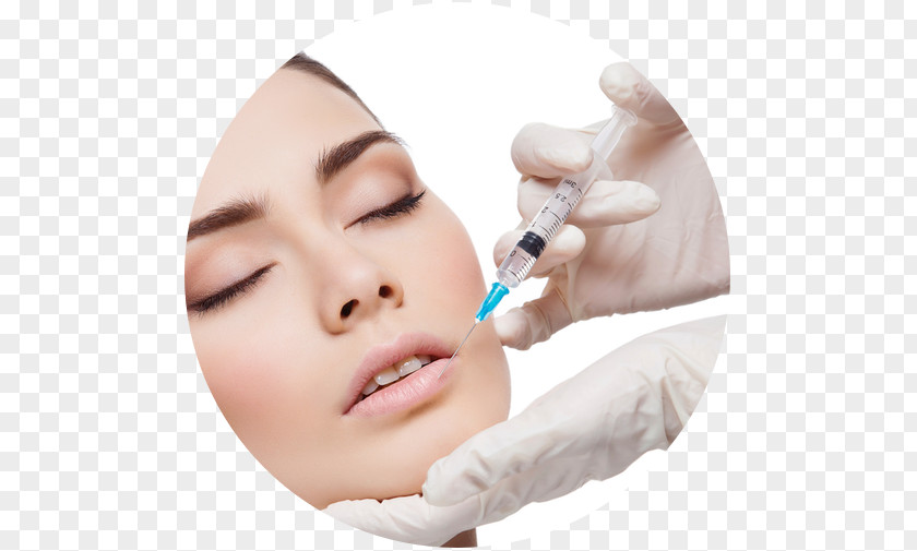 Face Injection Lip Surgery Skin Adverse Effect PNG