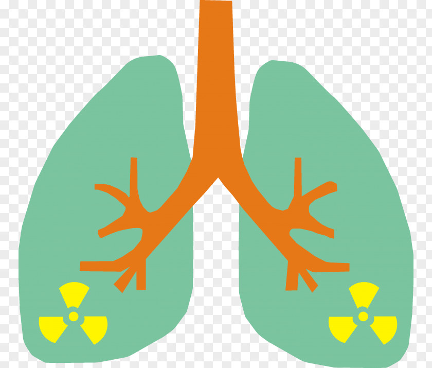 Lung Cancer Staging Radon Smoking PNG
