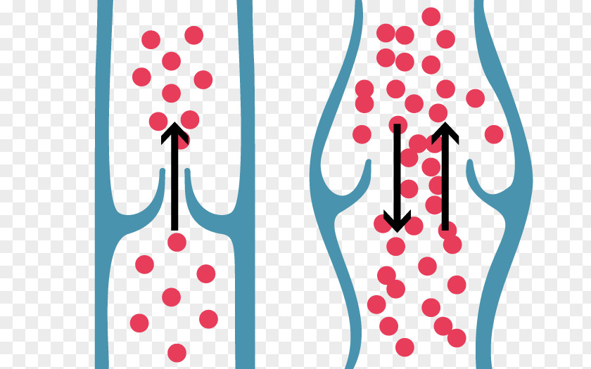 Varicose Veins Blood Leg Floodgate PNG veins Floodgate, blood clipart PNG