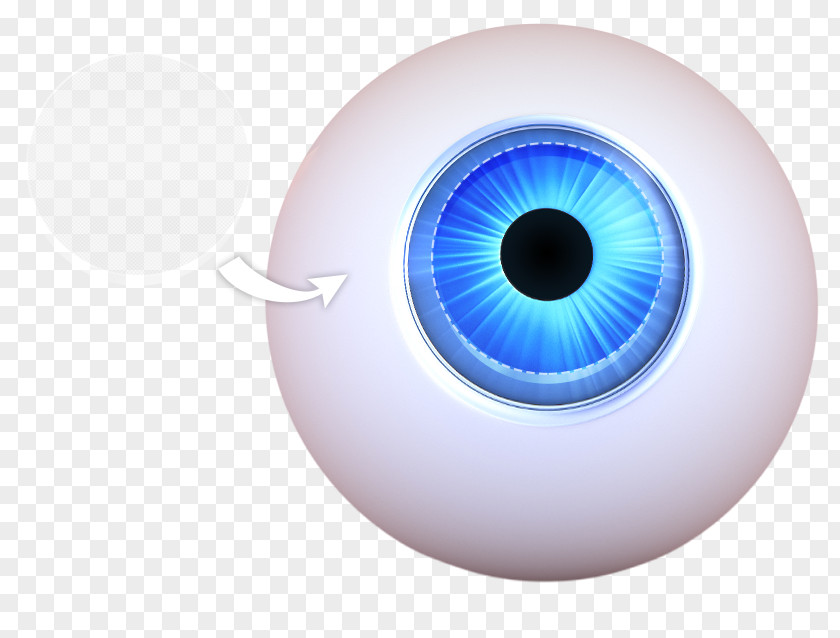 Eye Keratoprosthesis Corneal Transplantation Iris PNG