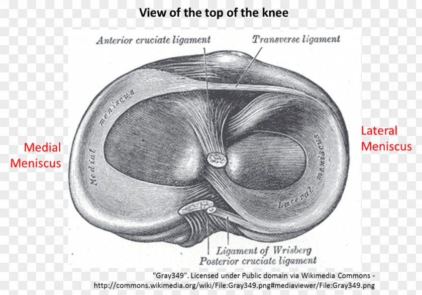 Tear Of Meniscus Anatomy Medial Lateral PNG