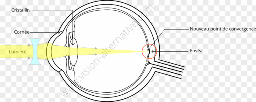 Eye Correction Technology Line Angle Font PNG