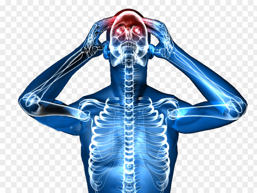 Headache Treatment Image Royalty-free Human Body Stock Photography PNG