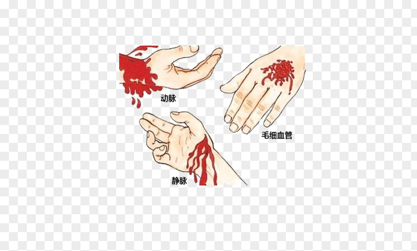Different Parts Of The Wound Emergency Bleeding Control First Aid Medical Sign PNG
