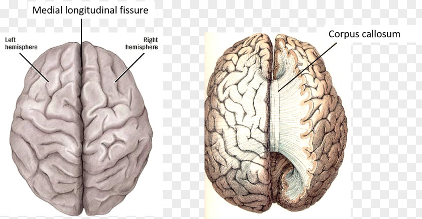 Brain Cerebral Hemisphere Lateralization Of Function Human Cortex PNG