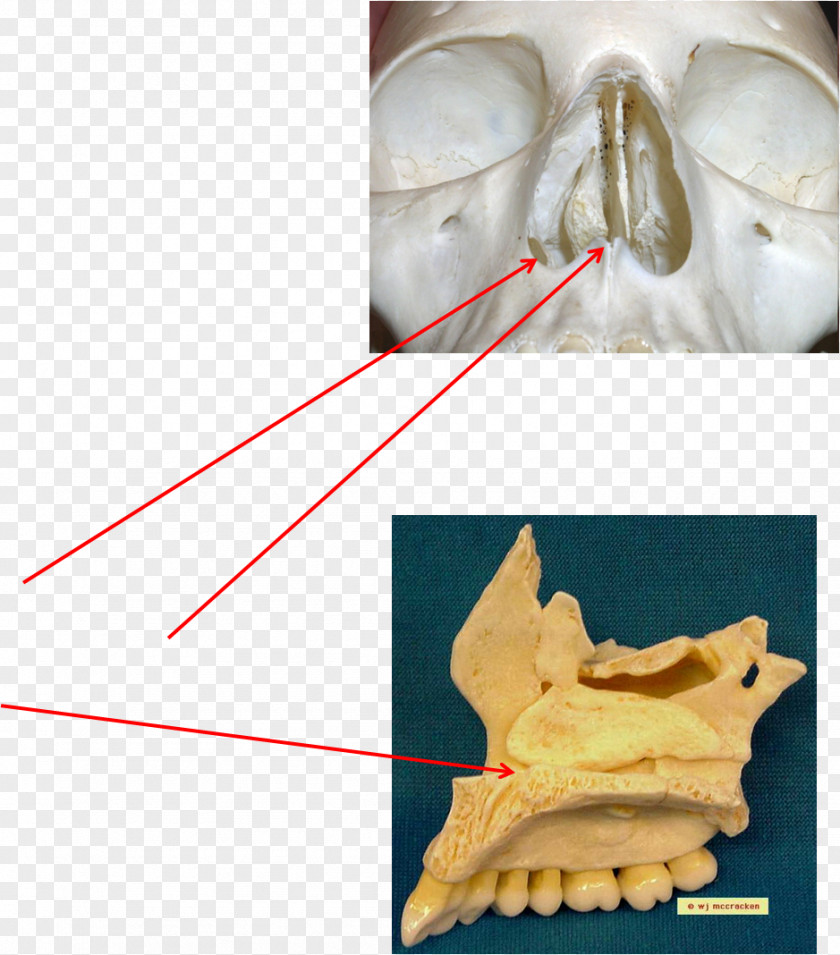 Skull Bone Maxilla Anatomy Joint Skeletal Pneumaticity PNG