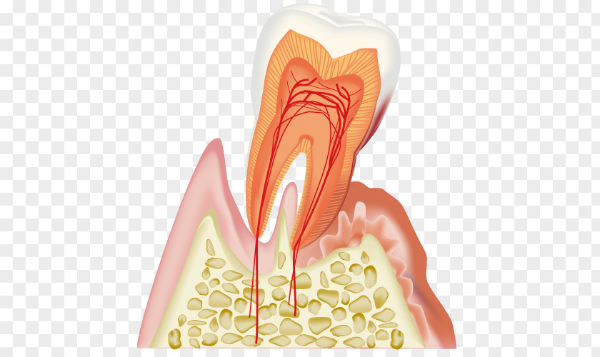 Gum Disease Dentistry Periodontal 歯科 Gums PNG