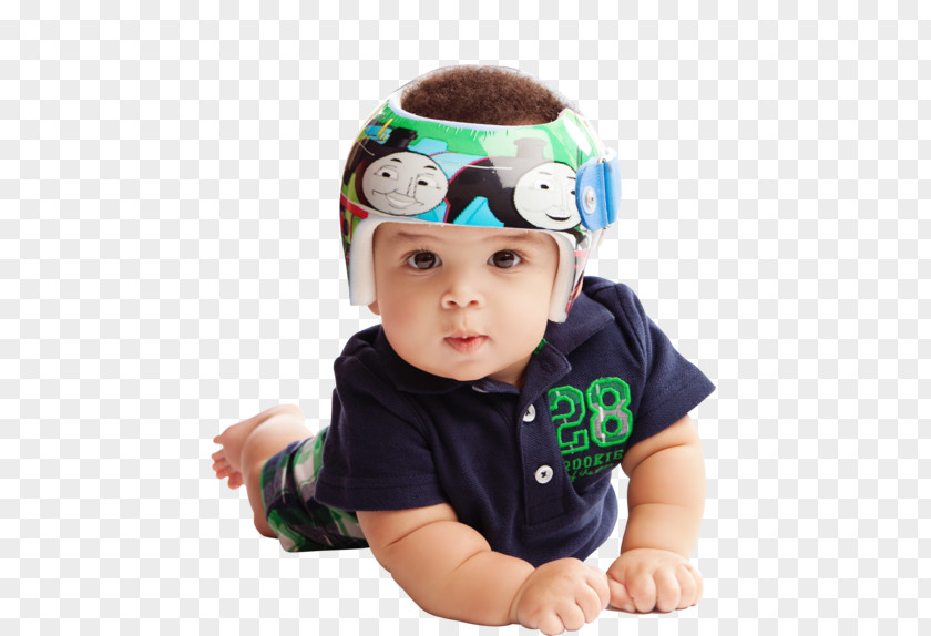 Skull Plagiocephaly Prosthesis Cervical Vertebrae Therapy PNG