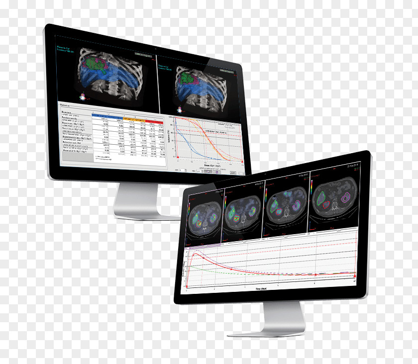 Nuclear Medicine Dosisoft Dosimetry Radiation Therapy PNG