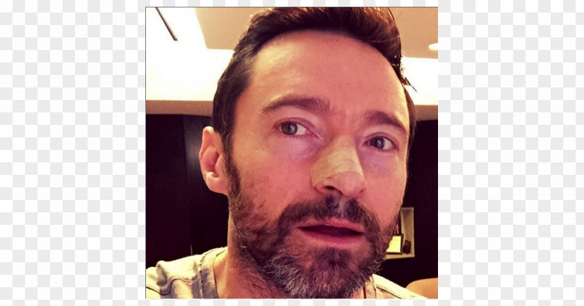 Hugh Jackman The Wolverine Sunscreen Skin Cancer Actor PNG