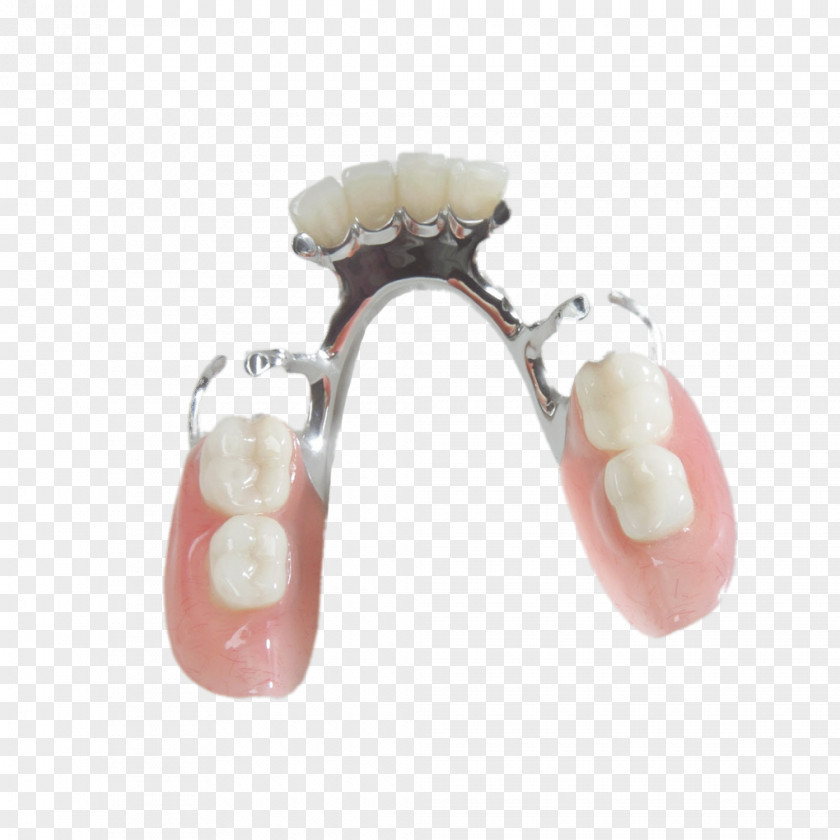 Crown Tooth Dentures Prosthesis Removable Partial Denture Dentistry PNG