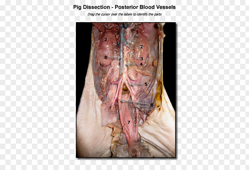 Pig Fetal Blood Vessel Dissection Anatomy PNG