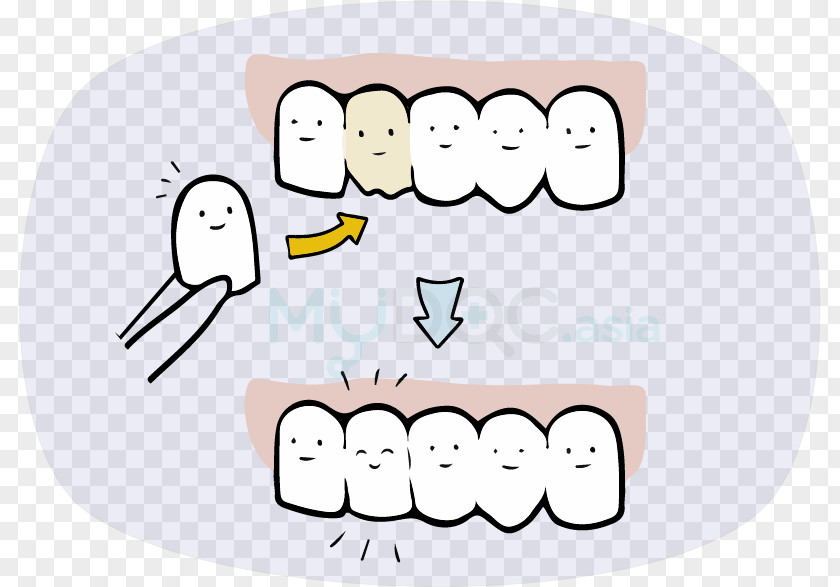 Coffee Stains Teeth Clip Art Human Behavior Tooth Mouth Jaw PNG