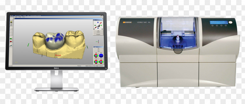 Dental Laboratory CAD/CAM Dentistry Crown Restoration Inlays And Onlays PNG