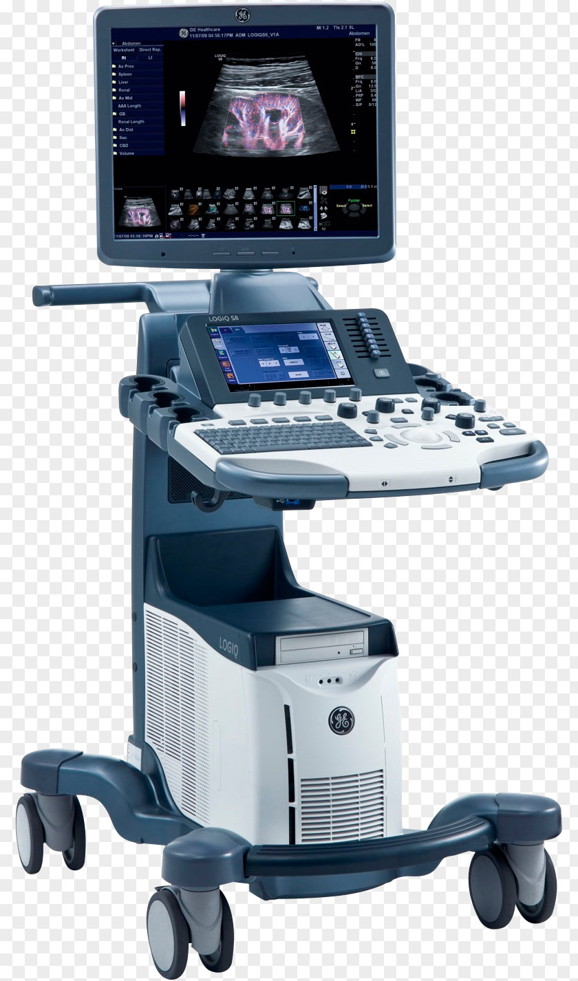 Voluson 730 Ultrasonography Ultrasound Medicine GE Healthcare PNG