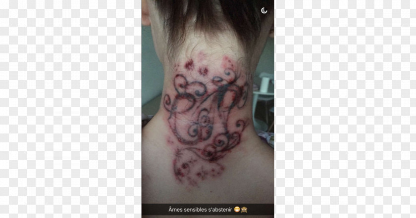 Caroline Receveur Secret Story Tattoo Laser Face Moncton PNG