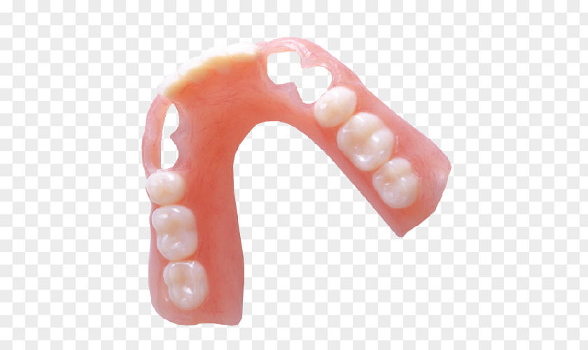 Dentures Removable Partial Denture Dental Laboratory Dentistry Vitallium PNG