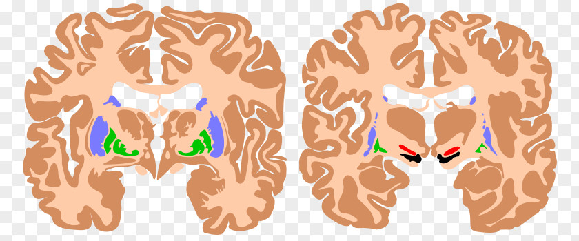 Brain Basal Ganglia Agy Substantia Nigra Ganglion PNG