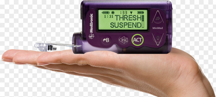Insulin Administration Pump Diabetes Mellitus Minimed Paradigm Type 1 PNG