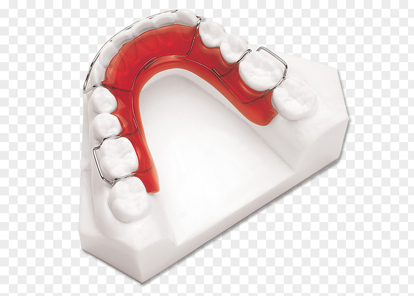 Retainer Jaw Orthodontics Mandible Tooth PNG