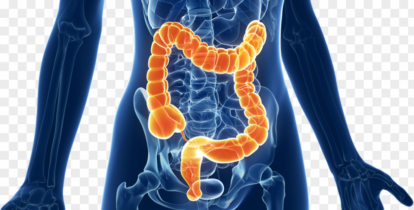 Sigmoidoscopy Large Intestine Colorectal Cancer Irritable Bowel Syndrome Gastrointestinal Tract PNG