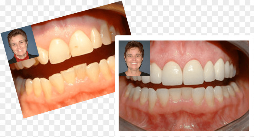Dental Smile Markham, Dr. Kevin M R. Markham DDS Dentist Unionville Tooth PNG