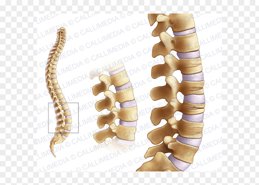 Osteoporosis Bone Fracture Joint Femoral Neck Rheumatology PNG